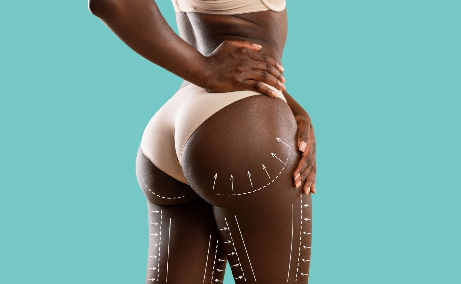 Non-Invasive Liquid BBL