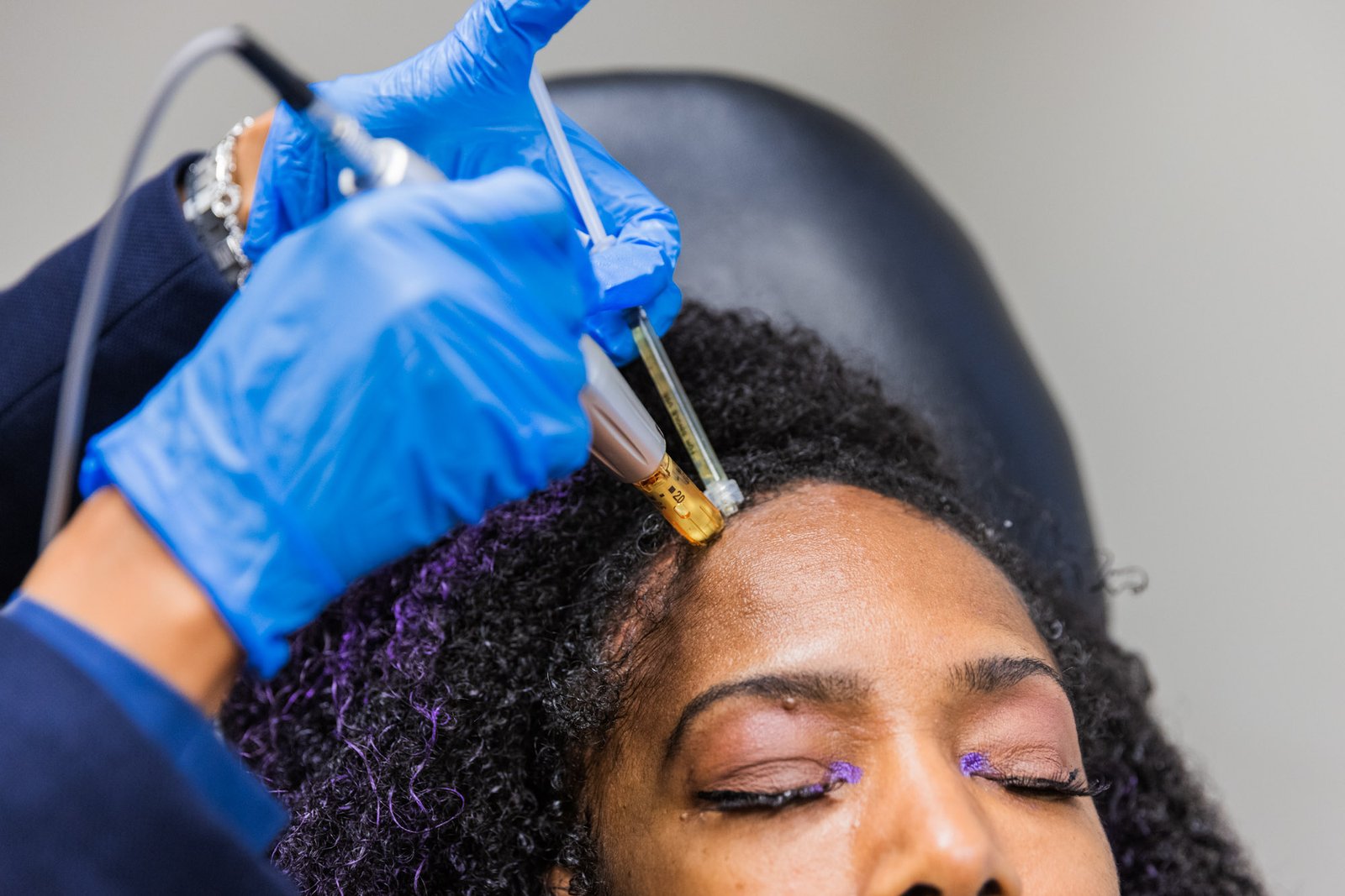 Platelet Rich Plasma (PRP)